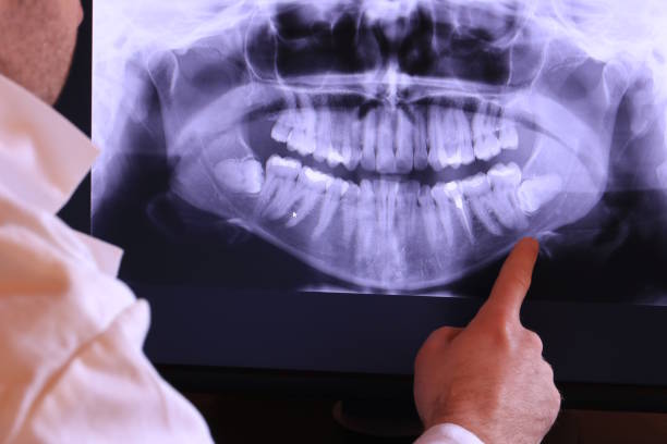 Best Broken or Chipped Tooth Repair in Pewee Valley, KY